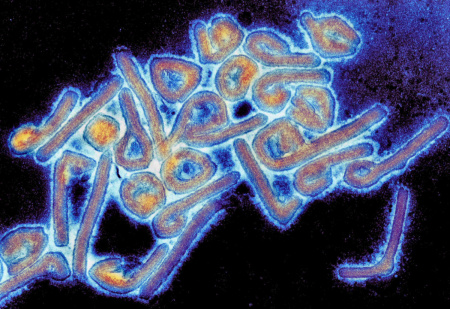 The Marburg virus under a microscope