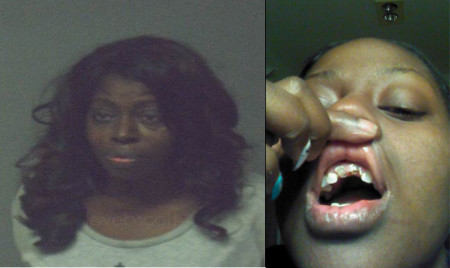 Angie Stone’s mugshot (left) and her daughter’s damaged teeth